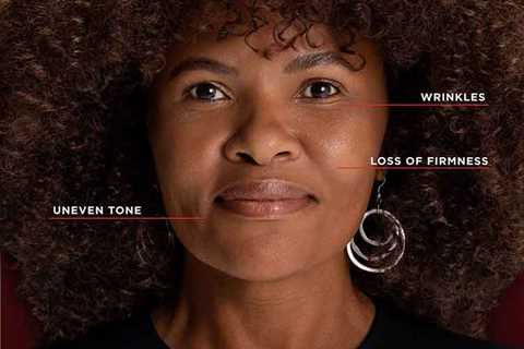 Dark Marks Hate To See Melasyl Coming. Here’s What It Can Really Do For Hyperpigmentation