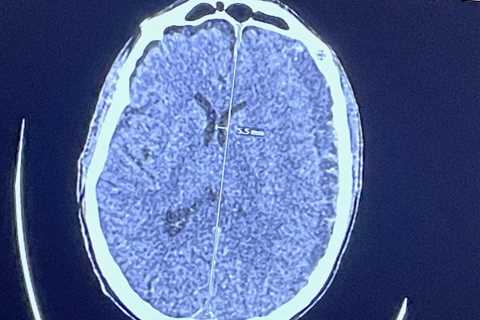 It’s not brain surgery … or is it?