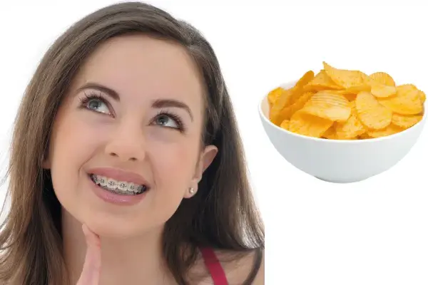 What Chips Can You Eat With Braces? Essential Guide for Snack Lovers - Dentist Decode
