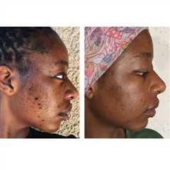 Real Radiance, Real Results
