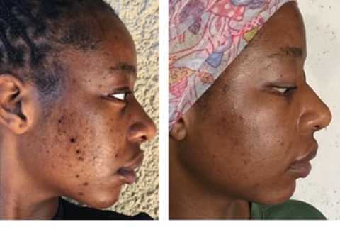 Real Radiance, Real Results